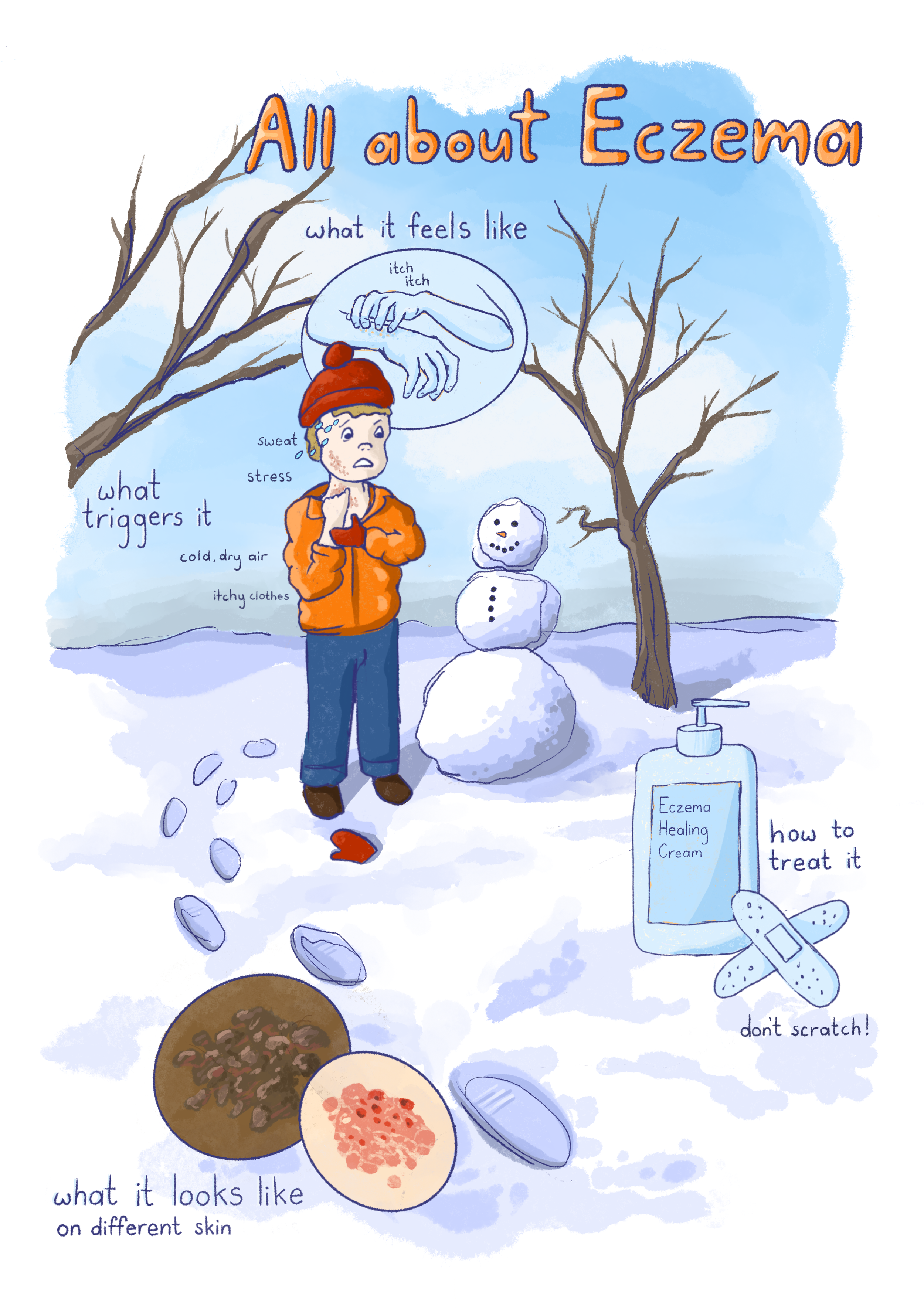 all about eczema educational poster